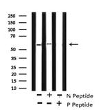 Phospho-Caspase 8 (Tyr448) Antibody in Western Blot (WB)