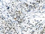 Phospho-CREB (Ser111) Antibody in Immunohistochemistry (Paraffin) (IHC (P))