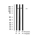 Phospho-Met (Tyr1235) Antibody in Western Blot (WB)