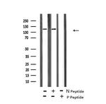 Phospho-ABL1/ABL2 (Tyr70, Tyr116) Antibody in Western Blot (WB)