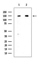 Phospho-DAPK1 (Ser734) Antibody in Western Blot (WB)