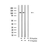 Phospho-EphA8 (Tyr616) Antibody in Western Blot (WB)