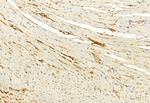 Phospho-FGFR2 (Tyr769) Antibody in Immunohistochemistry (Paraffin) (IHC (P))