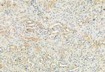 Phospho-FGFR2 (Tyr769) Antibody in Immunohistochemistry (Paraffin) (IHC (P))