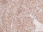 Phospho-FGFR2 (Tyr769) Antibody in Immunohistochemistry (Paraffin) (IHC (P))