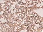 Phospho-FGFR2 (Tyr769) Antibody in Immunohistochemistry (Paraffin) (IHC (P))