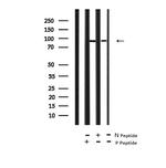 Phospho-FGFR2 (Tyr769) Antibody in Western Blot (WB)