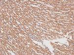 Phospho-FGR (Tyr412) Antibody in Immunohistochemistry (Paraffin) (IHC (P))