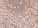 Phospho-FGR (Tyr412) Antibody in Immunohistochemistry (Paraffin) (IHC (P))