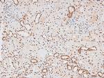 Phospho-JAK2 (Tyr119) Antibody in Immunohistochemistry (Paraffin) (IHC (P))