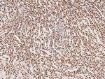 Phospho-JAK2 (Tyr119) Antibody in Immunohistochemistry (Paraffin) (IHC (P))