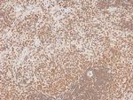 Phospho-JAK2 (Tyr119) Antibody in Immunohistochemistry (Paraffin) (IHC (P))