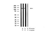 Phospho-JAK2 (Tyr119) Antibody in Western Blot (WB)