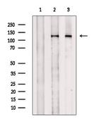 Phospho-JAK3 (Tyr904) Antibody in Western Blot (WB)