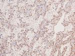 Phospho-JAK3 (Tyr981) Antibody in Immunohistochemistry (Paraffin) (IHC (P))