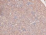 Phospho-JAK3 (Tyr981) Antibody in Immunohistochemistry (Paraffin) (IHC (P))