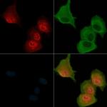 Phospho-MST3 (Thr18) Antibody in Immunocytochemistry (ICC/IF)