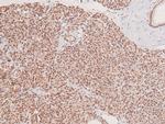 Phospho-MST3 (Thr18) Antibody in Immunohistochemistry (Paraffin) (IHC (P))