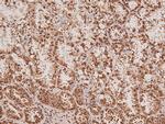 Phospho-ARK5 (Ser600) Antibody in Immunohistochemistry (Paraffin) (IHC (P))