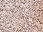 Phospho-ARK5 (Ser600) Antibody in Immunohistochemistry (Paraffin) (IHC (P))