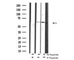 Phospho-PAK1 (Ser21) Antibody in Western Blot (WB)