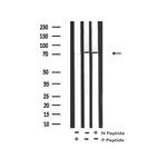 Phospho-cGKII (Ser126) Antibody in Western Blot (WB)