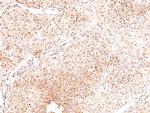 Phospho-ROS1 (Tyr2274) Antibody in Immunohistochemistry (Paraffin) (IHC (P))