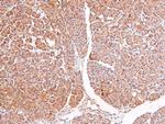 Phospho-RSK3 (Ser360) Antibody in Immunohistochemistry (Paraffin) (IHC (P))