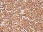 Phospho-SIK1 (Thr182) Antibody in Immunohistochemistry (Paraffin) (IHC (P))