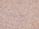 Phospho-TBK1 (Ser172) Antibody in Immunohistochemistry (Paraffin) (IHC (P))