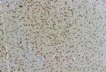 Phospho-TBK1 (Ser172) Antibody in Immunohistochemistry (Paraffin) (IHC (P))