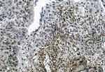 Phospho-TBK1 (Ser172) Antibody in Immunohistochemistry (Paraffin) (IHC (P))