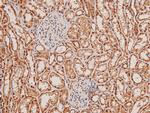 Phospho-TGFBR2 (Tyr284) Antibody in Immunohistochemistry (Paraffin) (IHC (P))