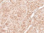 Phospho-TGFBR2 (Tyr284) Antibody in Immunohistochemistry (Paraffin) (IHC (P))