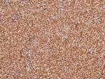 Phospho-TGFBR2 (Tyr284) Antibody in Immunohistochemistry (Paraffin) (IHC (P))