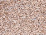 Phospho-TGFBR2 (Tyr284) Antibody in Immunohistochemistry (Paraffin) (IHC (P))