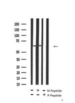 Phospho-TGFBR2 (Tyr284) Antibody in Western Blot (WB)