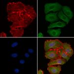 Phospho-FRS2 (Tyr196) Antibody in Immunocytochemistry (ICC/IF)