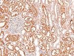 Phospho-FRS2 (Tyr196) Antibody in Immunohistochemistry (Paraffin) (IHC (P))