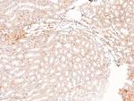 Phospho-FRS2 (Tyr196) Antibody in Immunohistochemistry (Paraffin) (IHC (P))