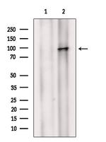 Phospho-Androgen Receptor (Ser83) Antibody in Western Blot (WB)