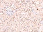 Phospho-LAT (Tyr161) Antibody in Immunohistochemistry (Paraffin) (IHC (P))