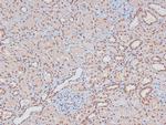 Phospho-LAT (Tyr161) Antibody in Immunohistochemistry (Paraffin) (IHC (P))