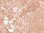 Phospho-LAT (Tyr161) Antibody in Immunohistochemistry (Paraffin) (IHC (P))