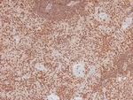 Phospho-LAT (Tyr161) Antibody in Immunohistochemistry (Paraffin) (IHC (P))