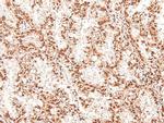 Phospho-eIF2b epsilon (Ser540) Antibody in Immunohistochemistry (Paraffin) (IHC (P))