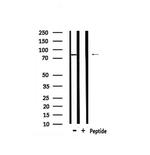 Phospho-eIF2b epsilon (Ser540) Antibody in Western Blot (WB)