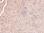 Phospho-RARA/RARB (Ser96) Antibody in Immunohistochemistry (Paraffin) (IHC (P))