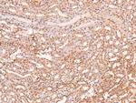 Phospho-LRP1 (Ser4520) Antibody in Immunohistochemistry (Paraffin) (IHC (P))