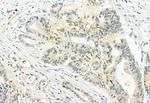 Phospho-ERK1/ERK2 (Thr202, Tyr204, Thr185, Tyr187) Antibody in Immunohistochemistry (Paraffin) (IHC (P))